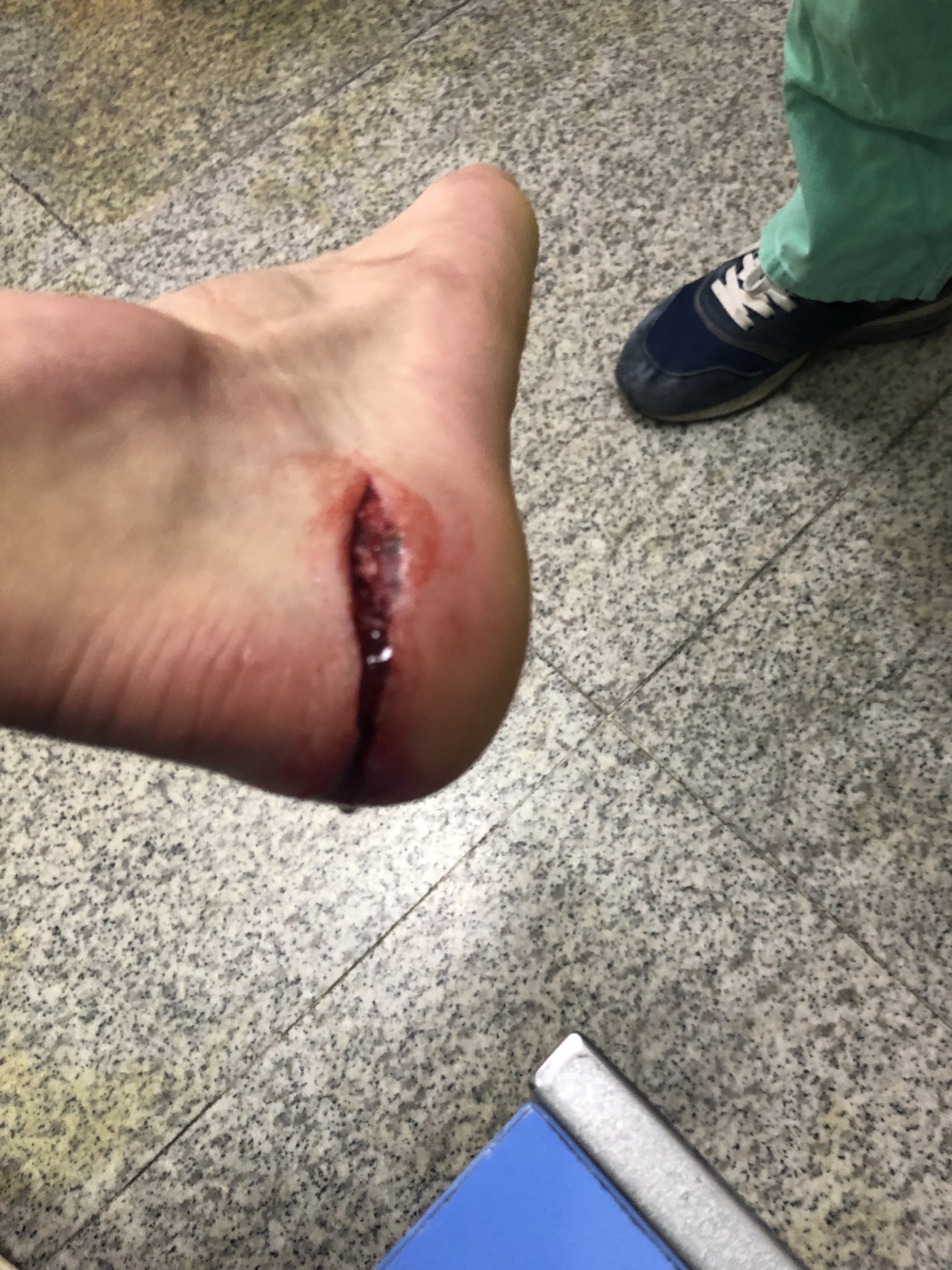 太阳城集团-比赛过程中出现的技术失误带来了意外的结果(比赛过程中出现的技术失误带来了意外的结果英语)